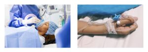 Patient undergoing general anesthesia in dentistry with face mask in a clinical setting at Innova Prosthodontics.