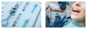 Local dental anesthesia injection with syringe and tools used in dentistry at Innova Prosthodontics.